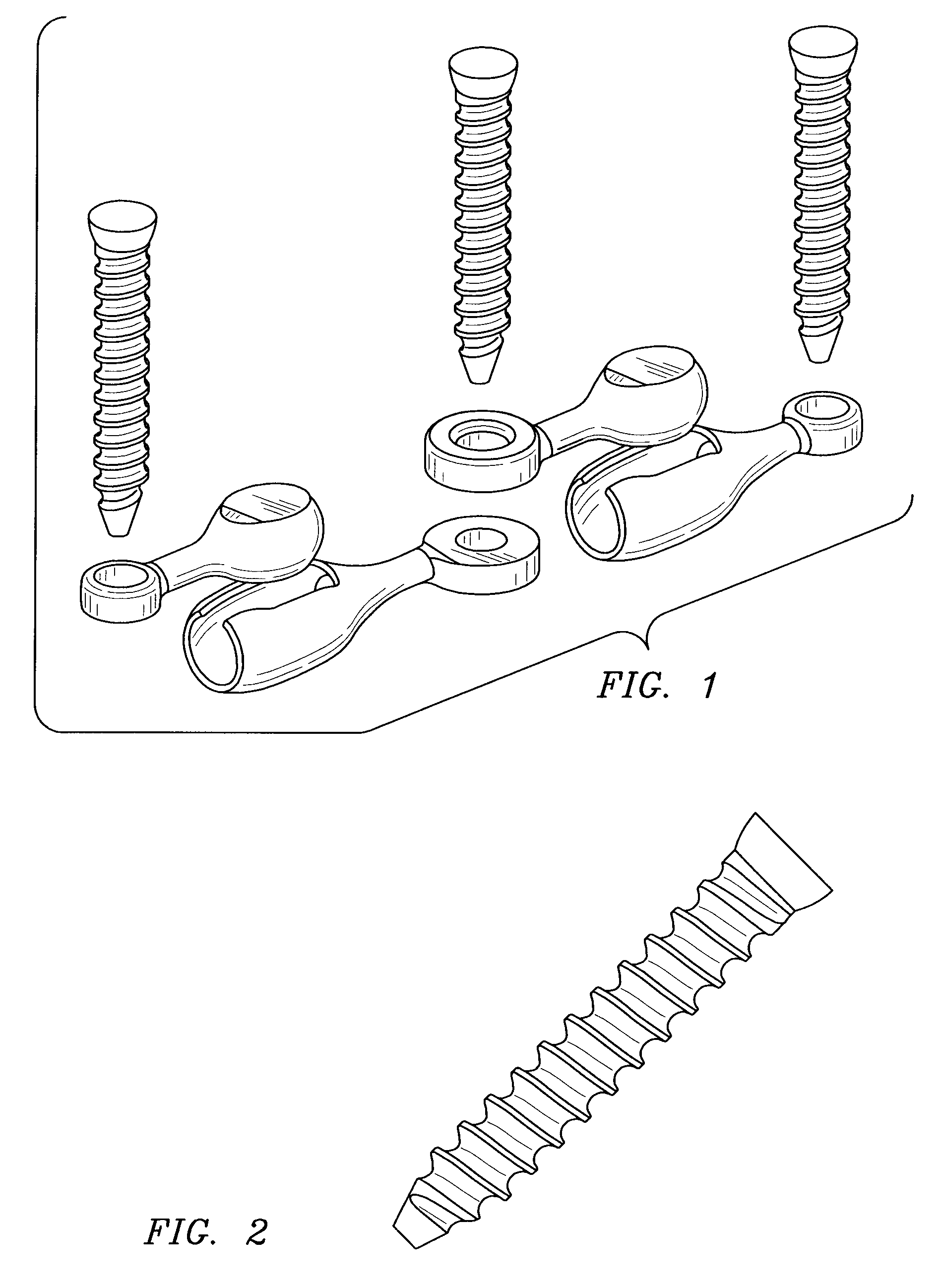 Facet joint prosthetic replacement and method