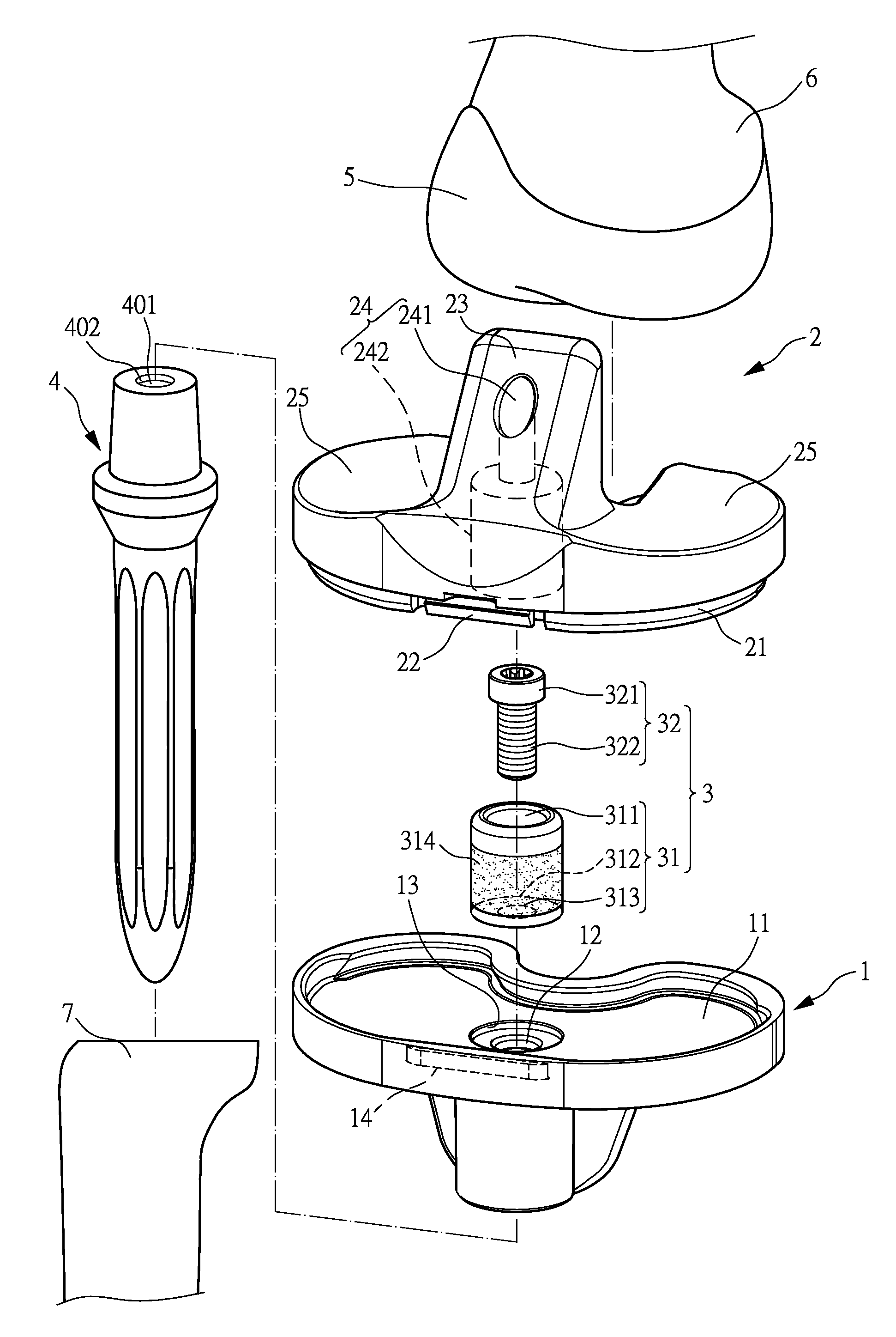 Structure improvement of an orthopaedic implant of an artificial knee joint