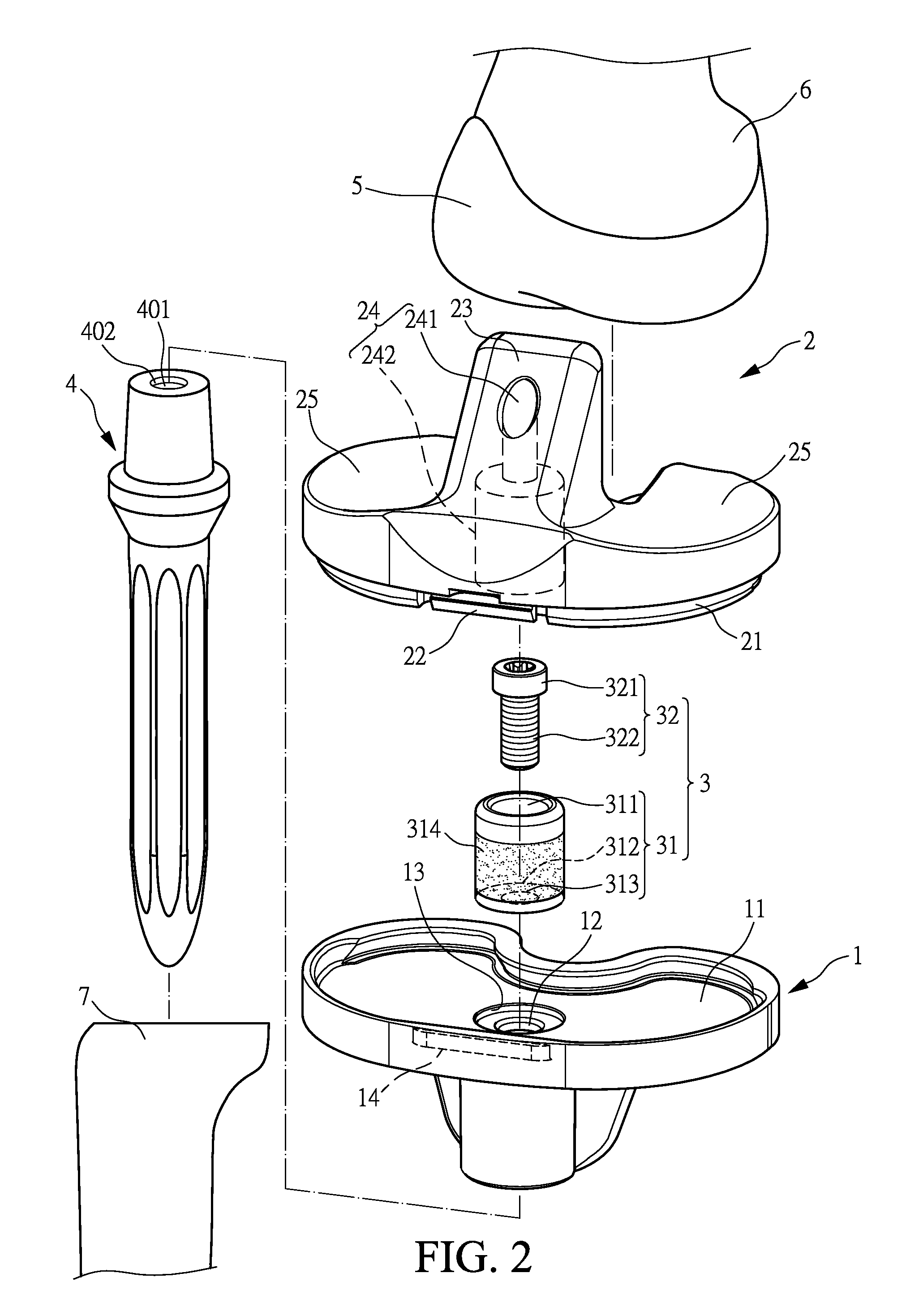 Structure improvement of an orthopaedic implant of an artificial knee joint