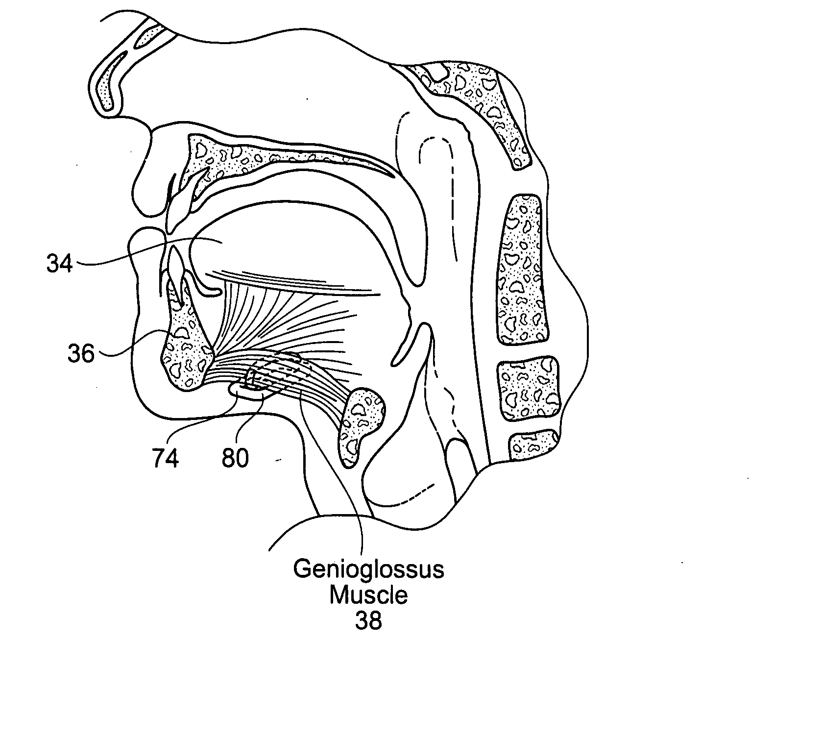 Implantable devices, systems, and methods for maintaining desired orientations in targeted tissue regions