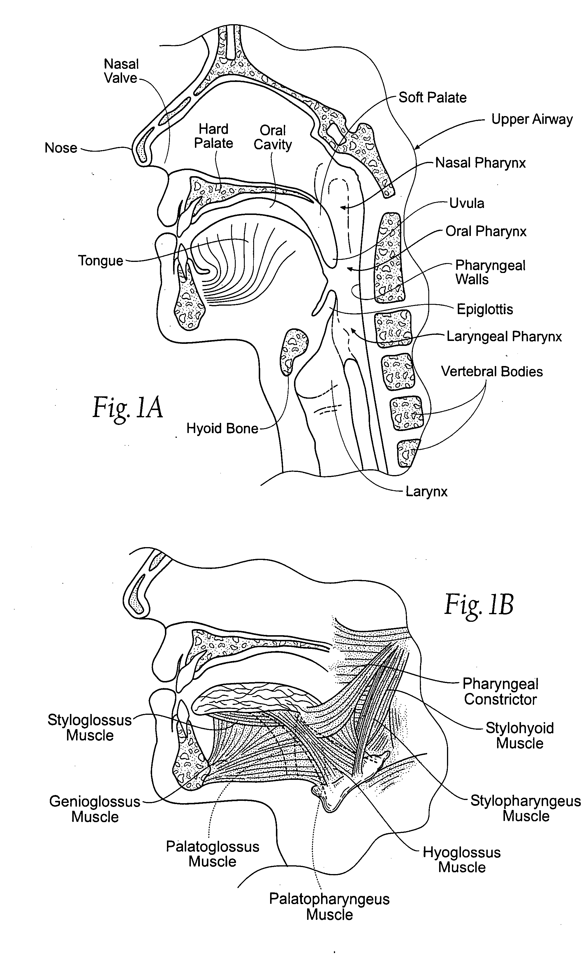 Implantable devices, systems, and methods for maintaining desired orientations in targeted tissue regions