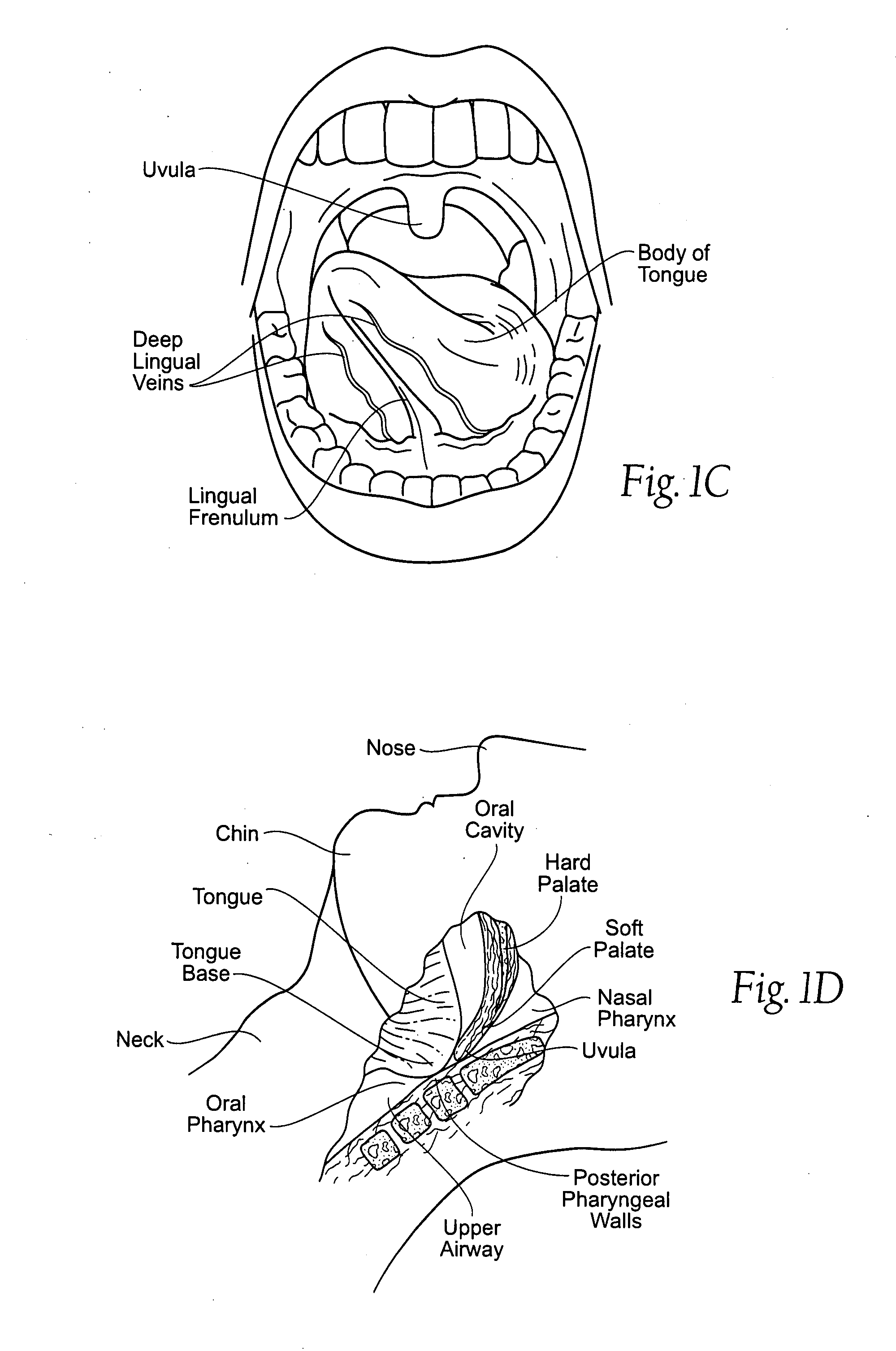 Implantable devices, systems, and methods for maintaining desired orientations in targeted tissue regions