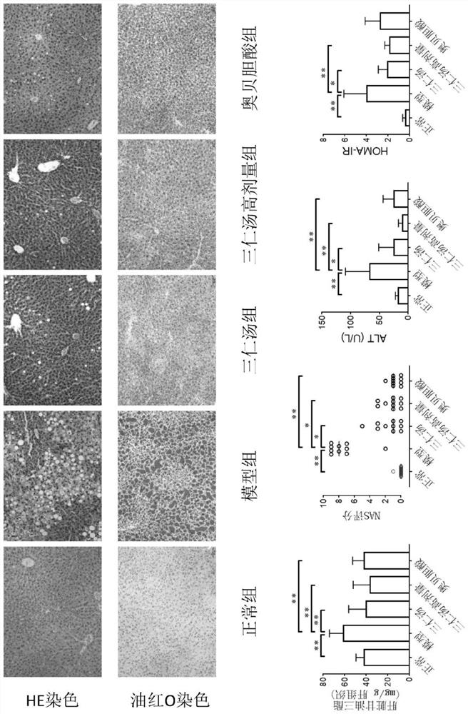 Application of three-kernel decoction to preparation of medicine for treating fatty liver disease