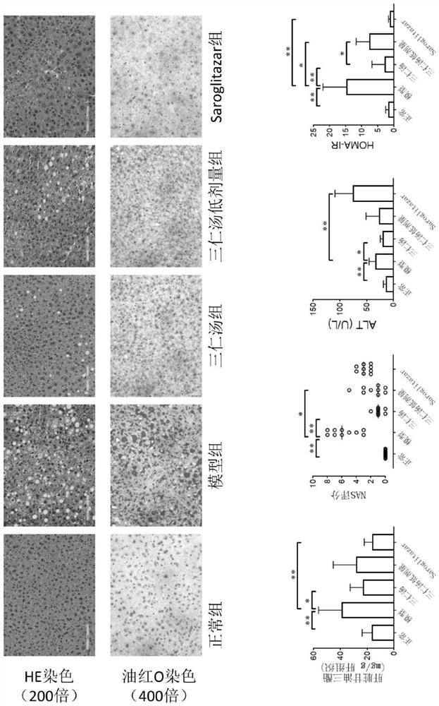 Application of three-kernel decoction to preparation of medicine for treating fatty liver disease