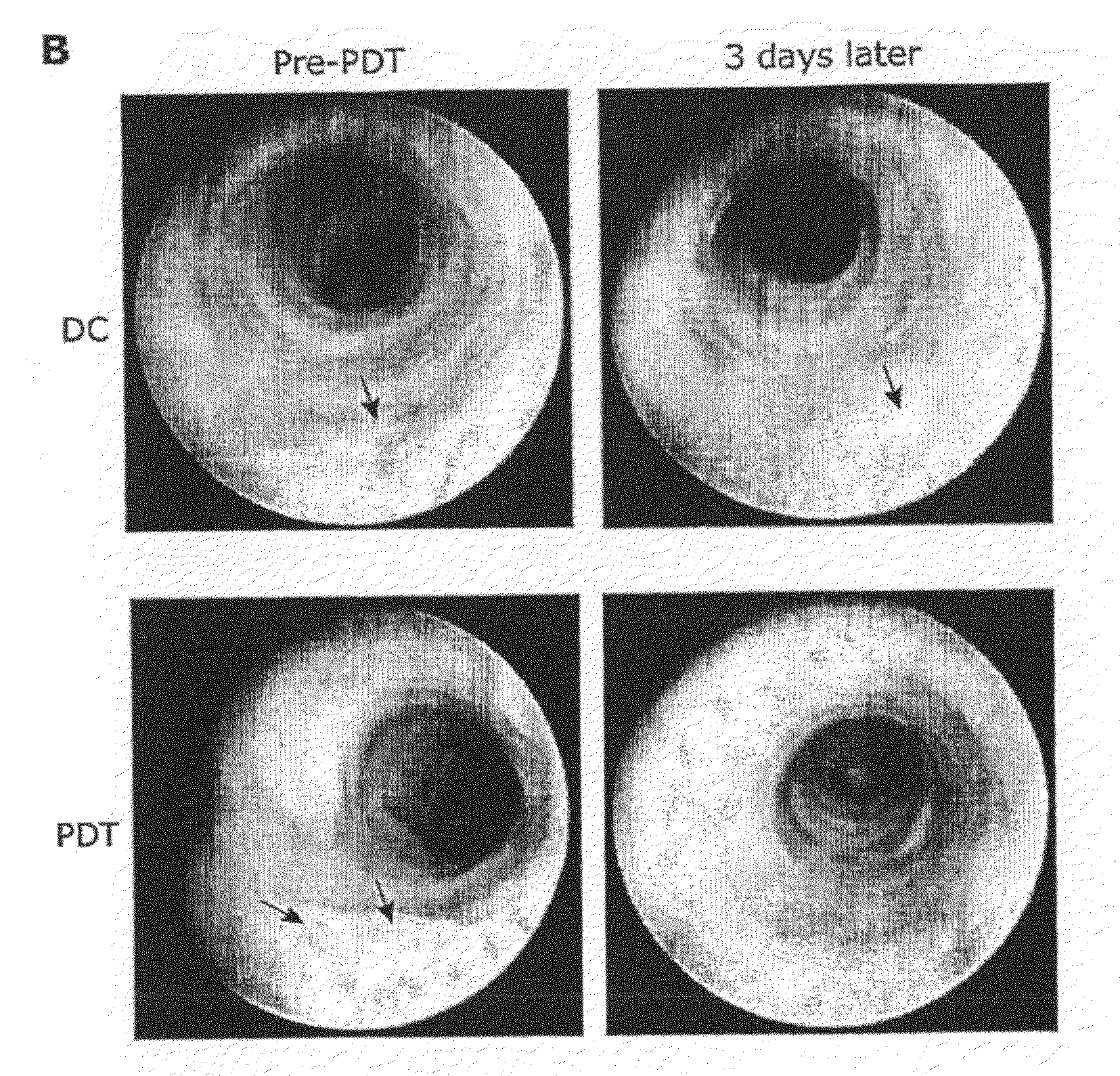 Use of a Photosensitizing Agent in the Treatment or Prevention of an Inflammation-Associated Disorder in the Gastrointestinal Tract of a Mammal