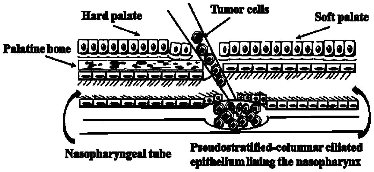 Construction method of improved human nasopharyngeal cancer in-situ transplantation tumor model