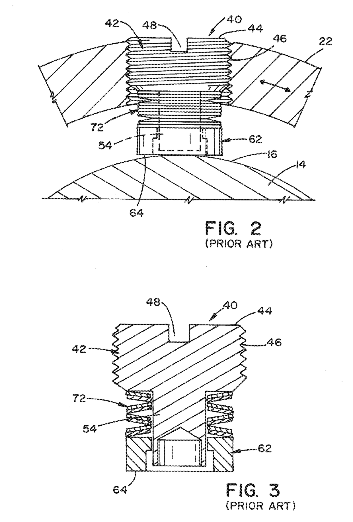 Brake screw for surgical lighting systems