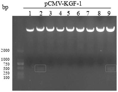 Recombinant human keratinocyte growth factor-1 and preparation and application methods thereof