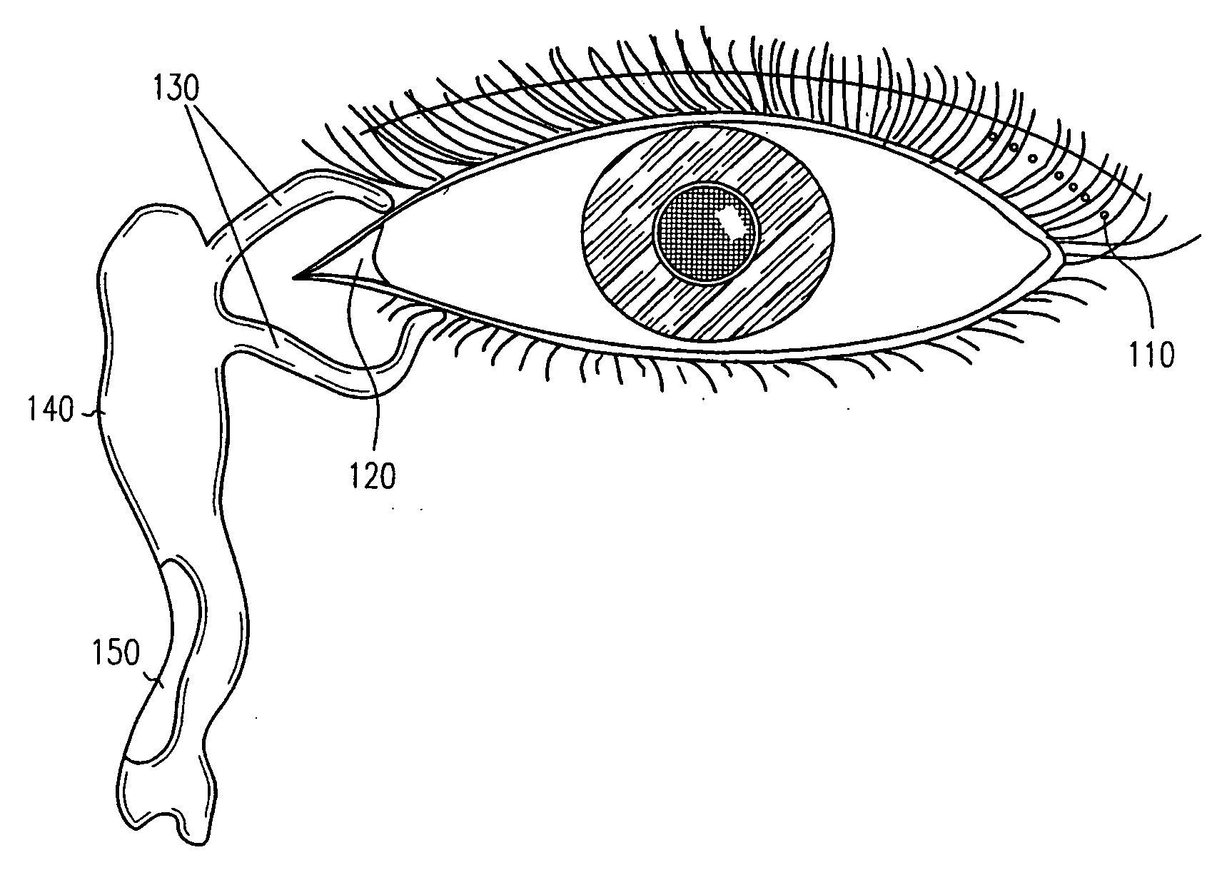 Adhesive bioerodible ocular drug delivery system