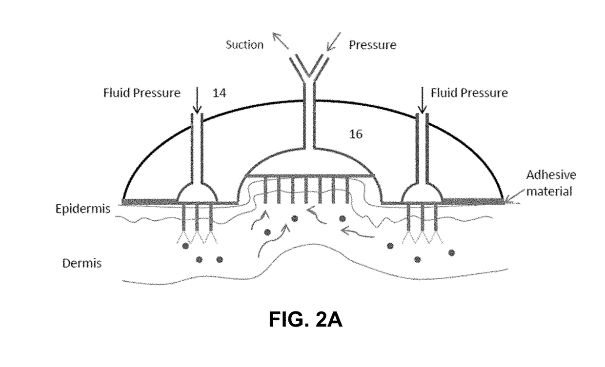 Systems and methods for removing exogenous particles from the skin of a patient