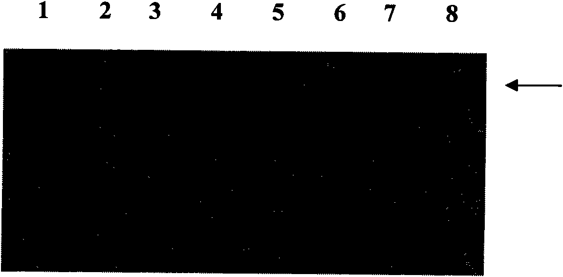 Surface protein of streptococcus suis type-2, preparation method thereof and application