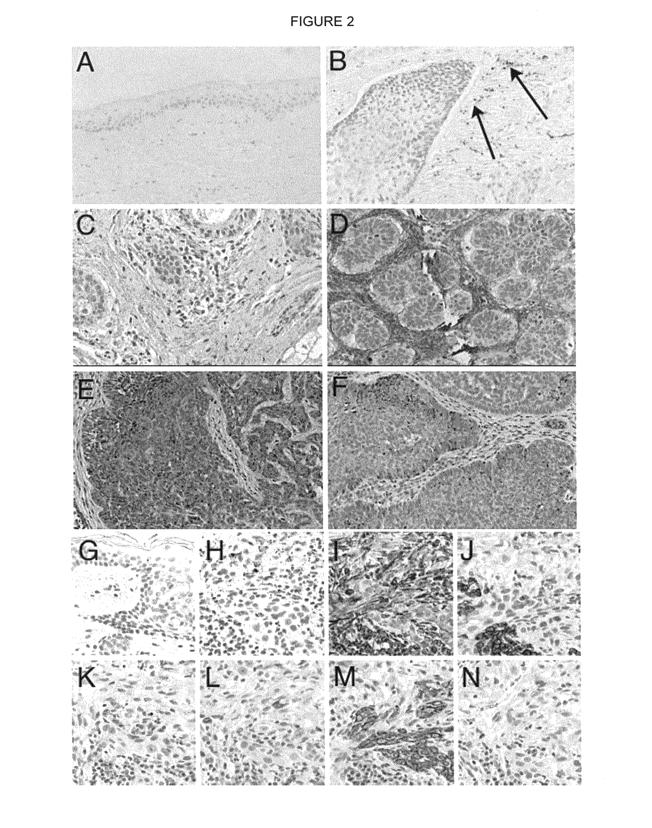 Bone morphogenetic protein antagonist and uses thereof