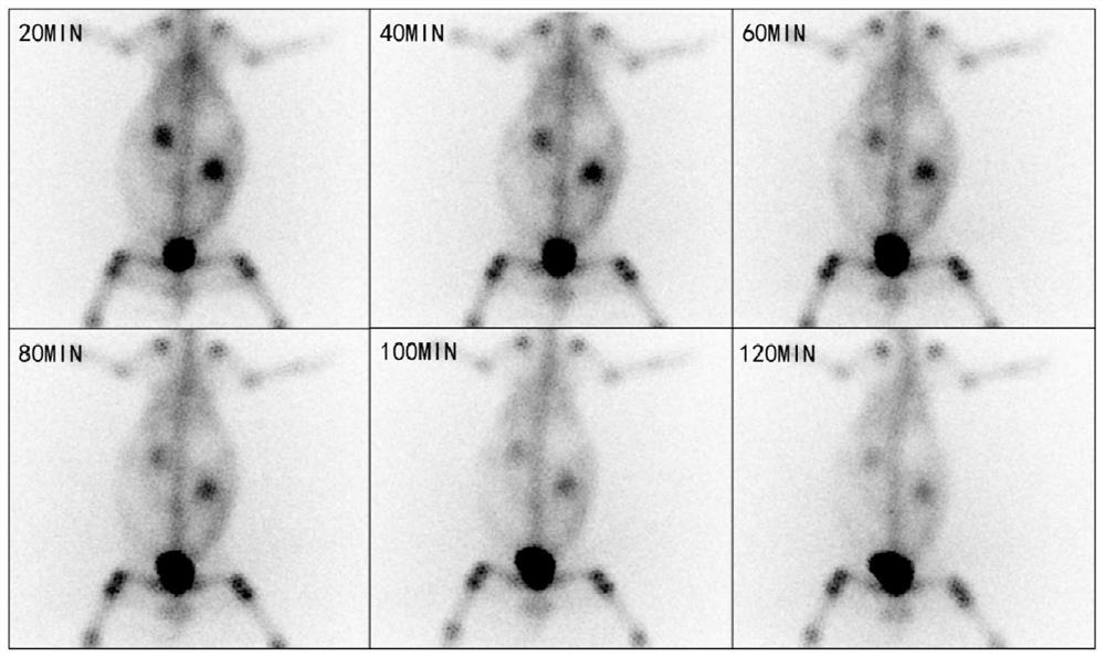 Medicine with imaging and metastatic bone tumor treatment functions as well as preparation method and application of medicine