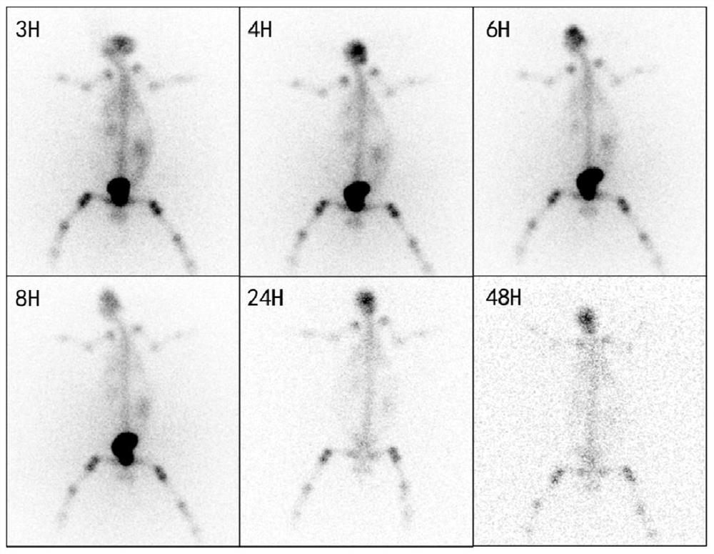 Medicine with imaging and metastatic bone tumor treatment functions as well as preparation method and application of medicine