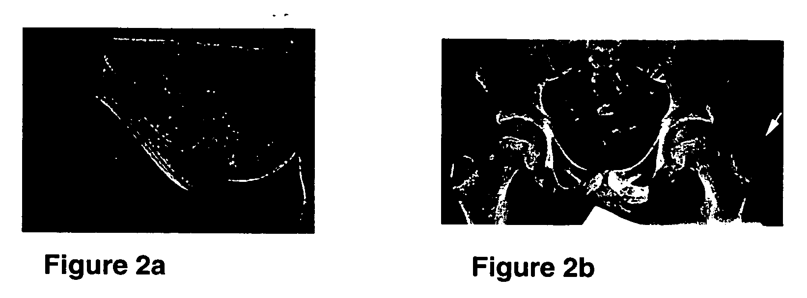 Compositions and methods for treating disorders associated with abnormal phosphate metabolism