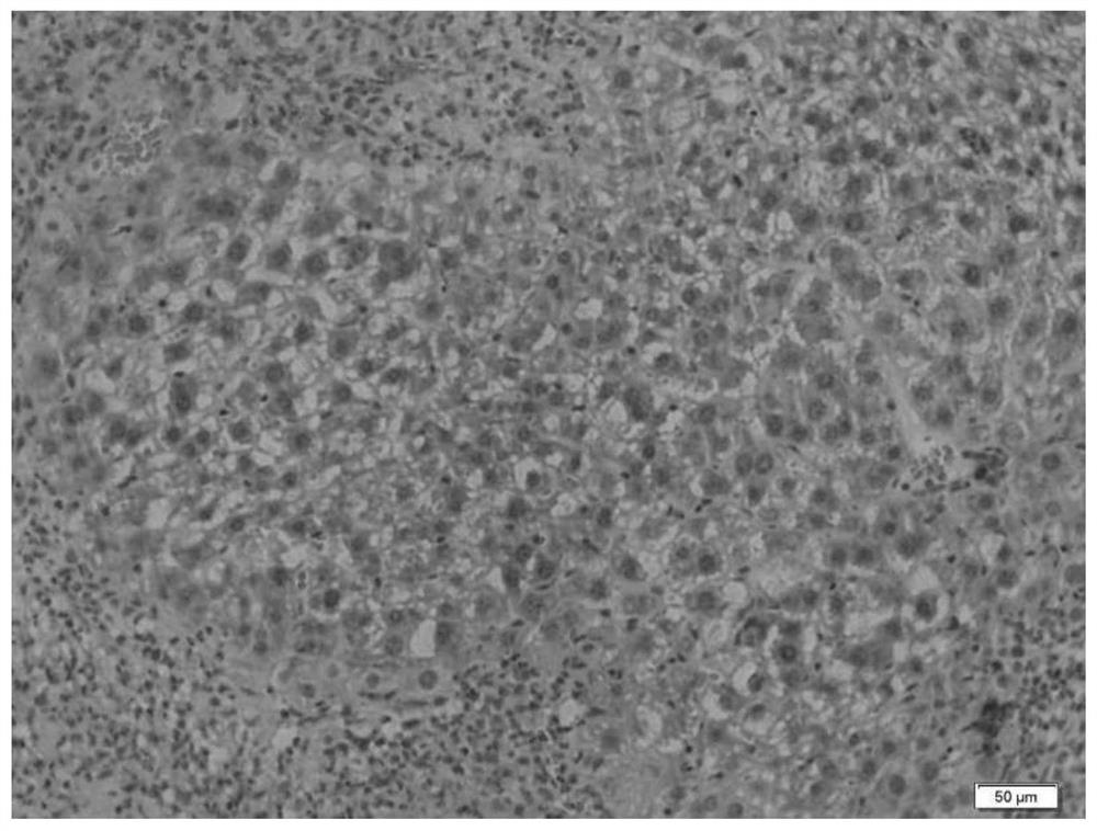 Preparation method of mouse orthotopic transplantation liver cancer model