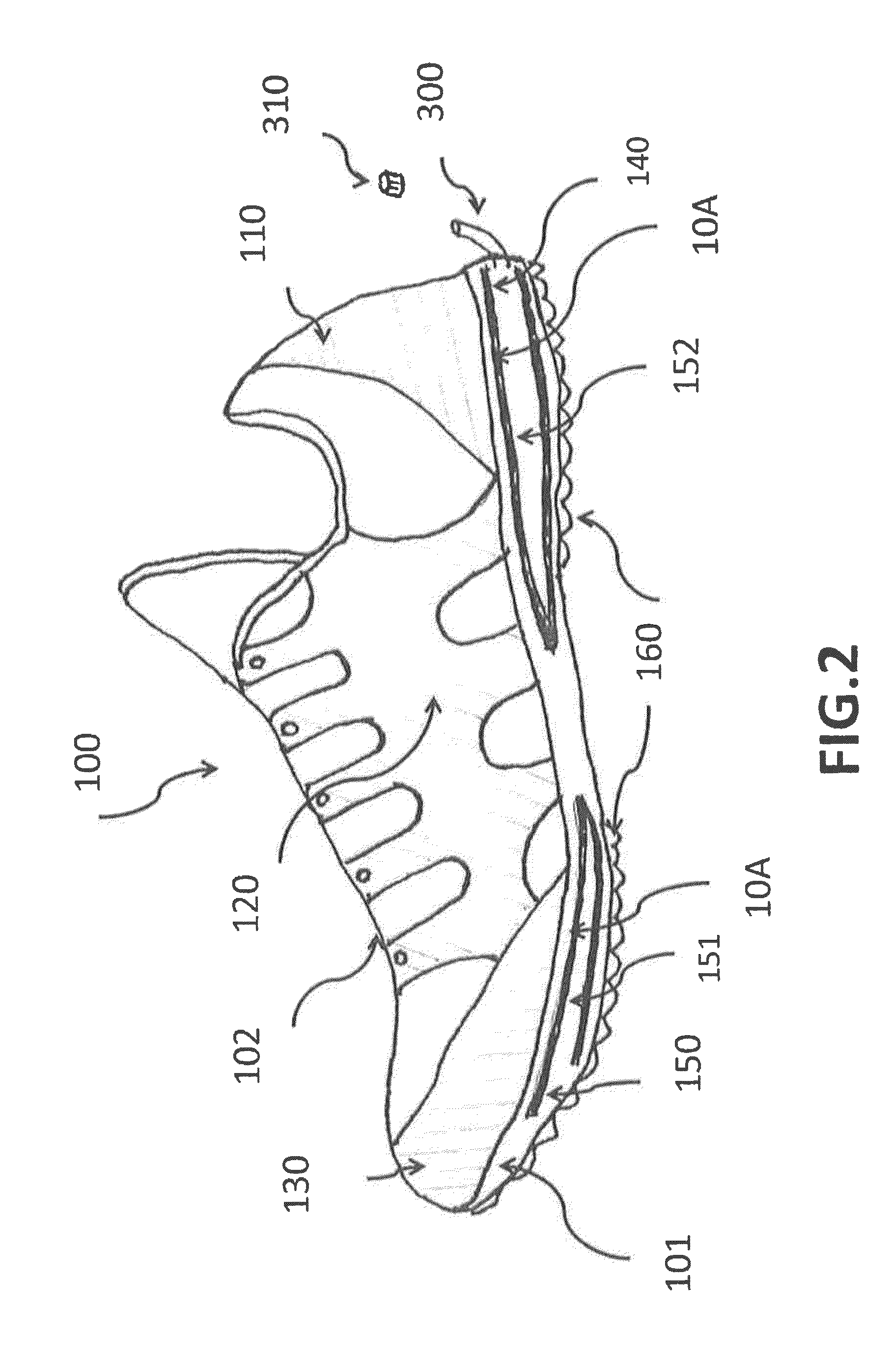 Shoe having carbon fiber composite spring soles and upper support