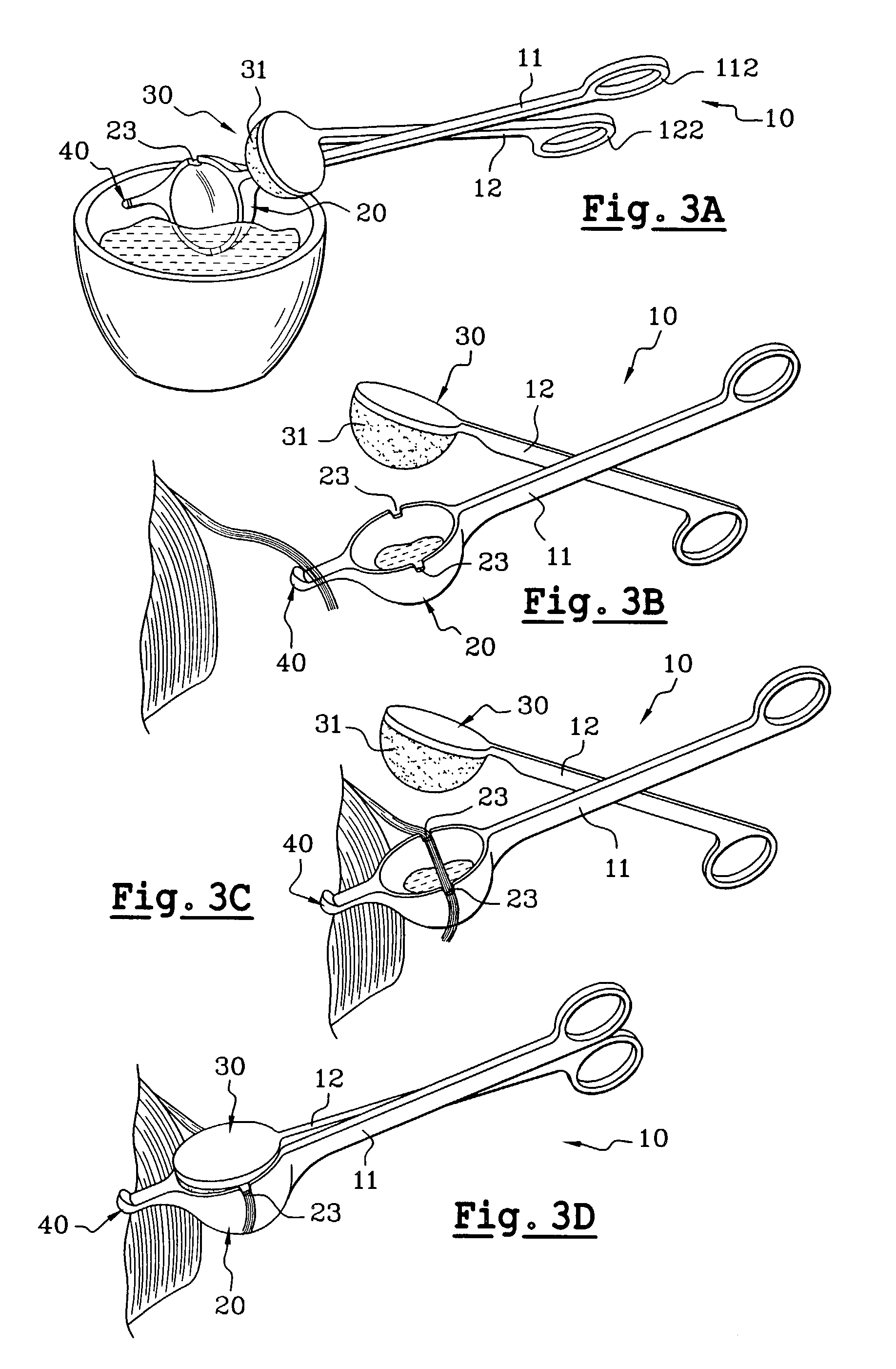 Device for the application of a hair product to sections of hair