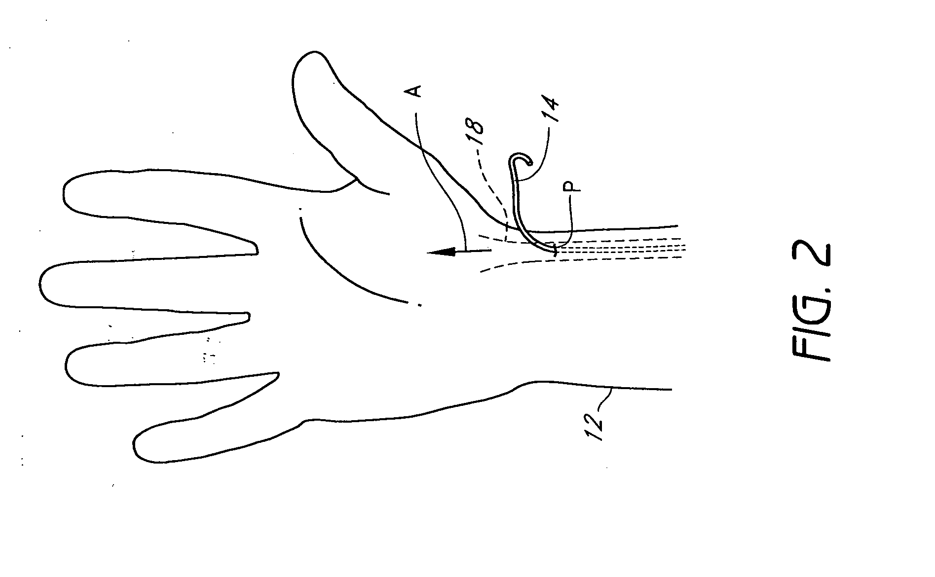 Cardiac output measurement devices and methods