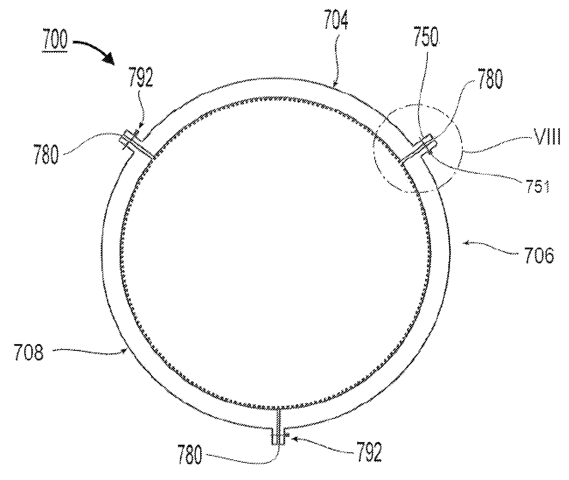 Inlet section of an aircraft engine nacelle