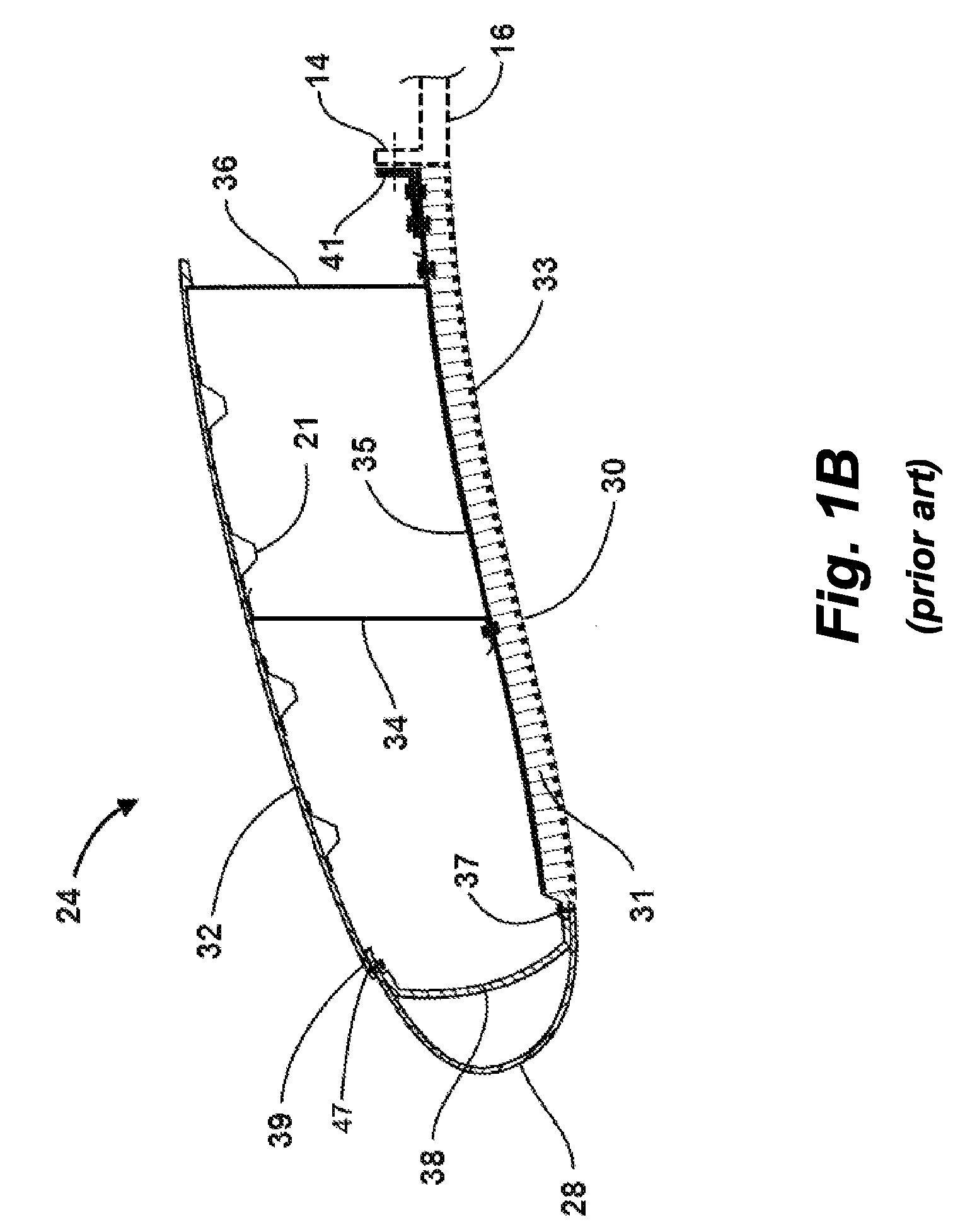 Inlet section of an aircraft engine nacelle