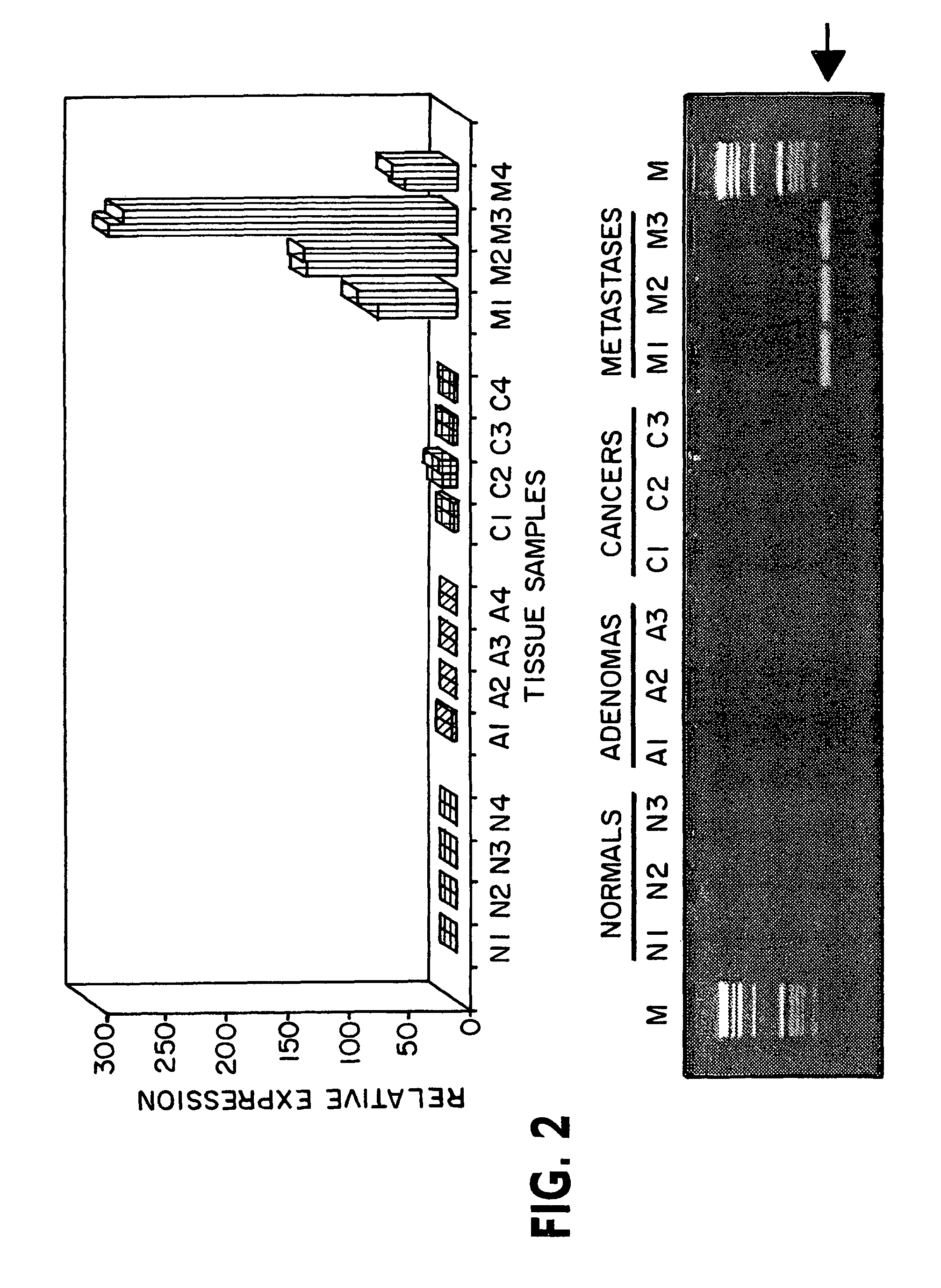 Phosphatase associated with metastasis