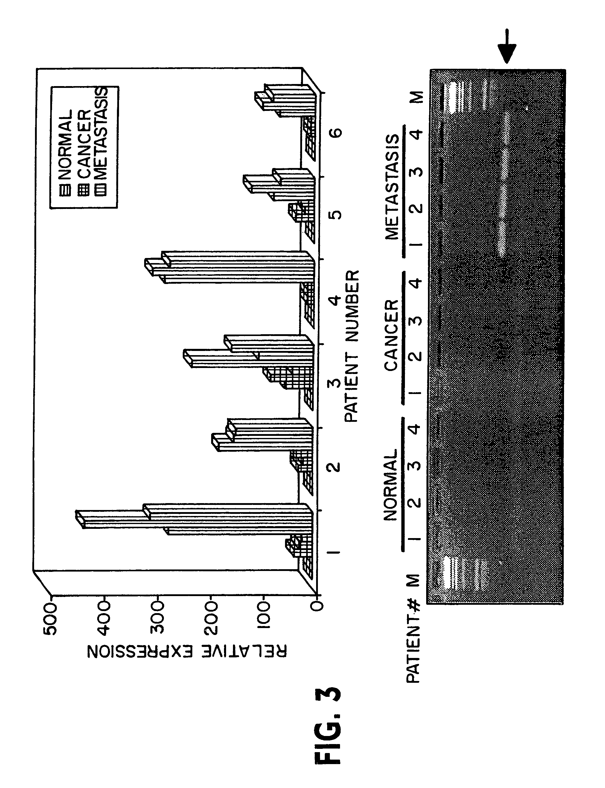 Phosphatase associated with metastasis