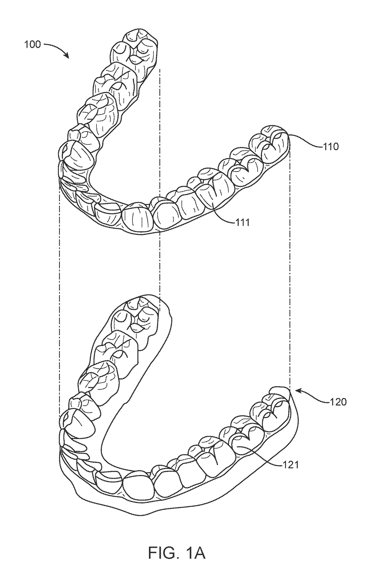 Systems, methods, and apparatus for correcting malocclusions of teeth