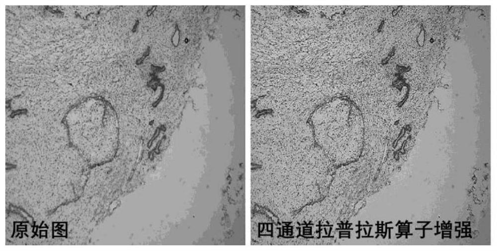 Breast tissue classification and identification method based on transfer learning