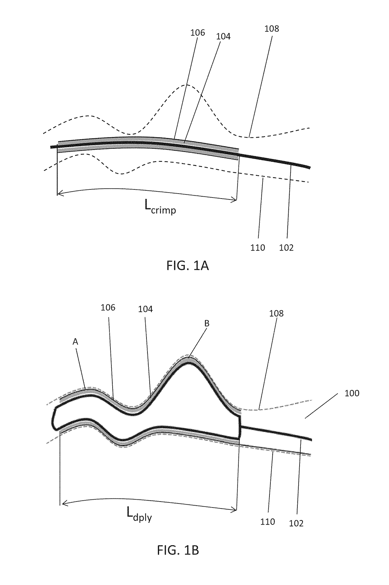 Shape change structure for treatment of nasal conditions including sinusitis