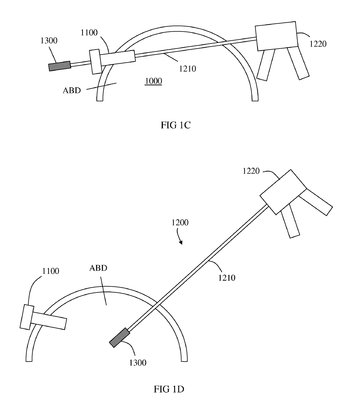 Micro laparoscopy devices and deployments thereof