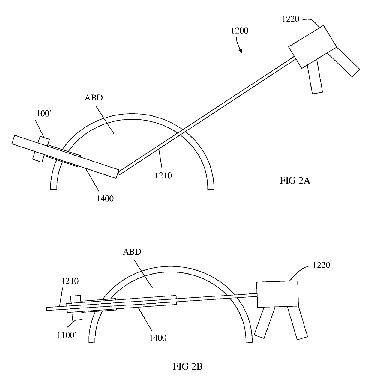 Micro laparoscopy devices and deployments thereof