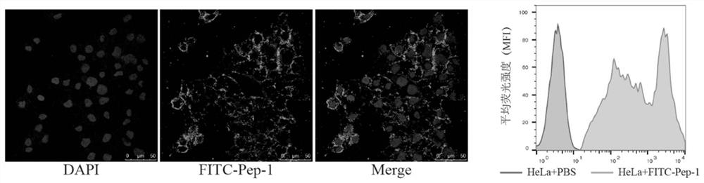 Tumor molecular probe for targeting cervical cancer and application thereof