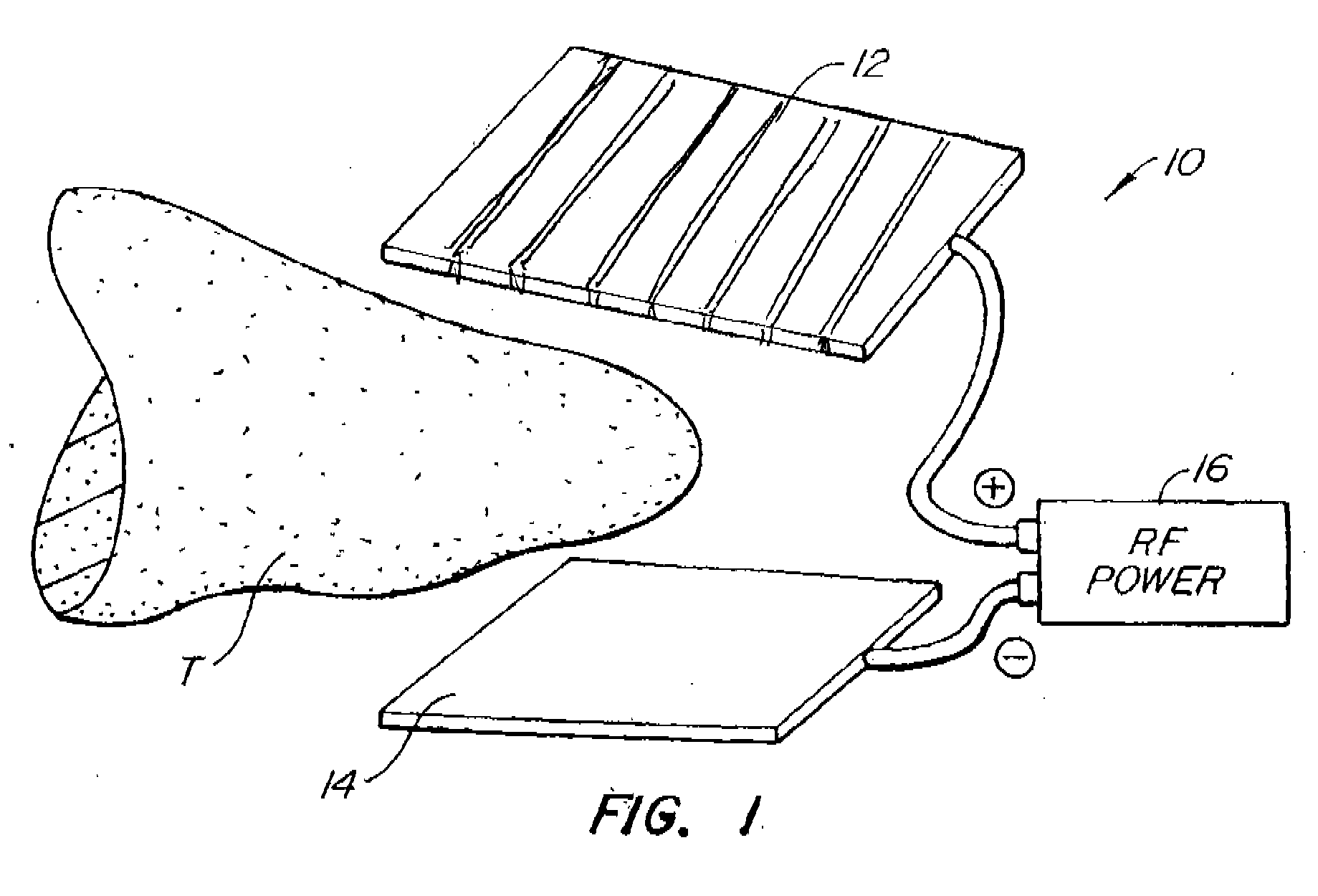 Apparatus for Tissue Cauterization