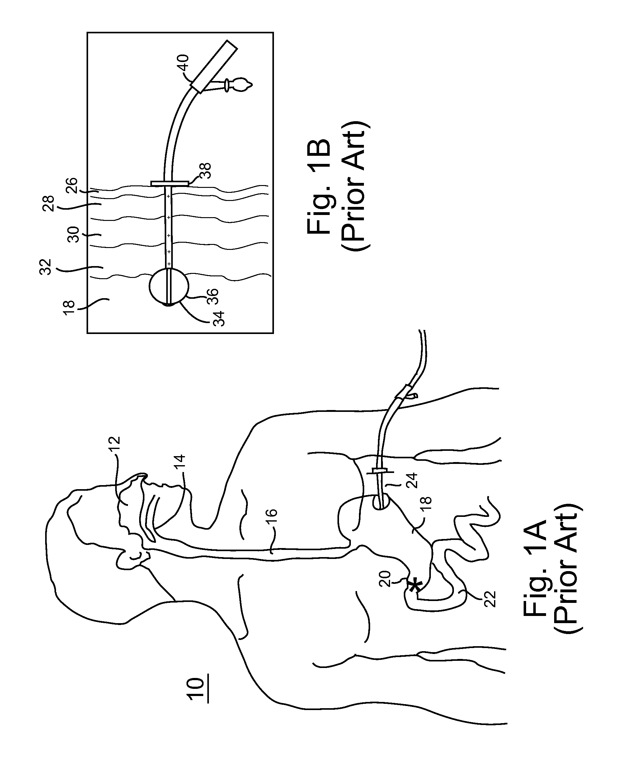 Partially disposable endoscopic device