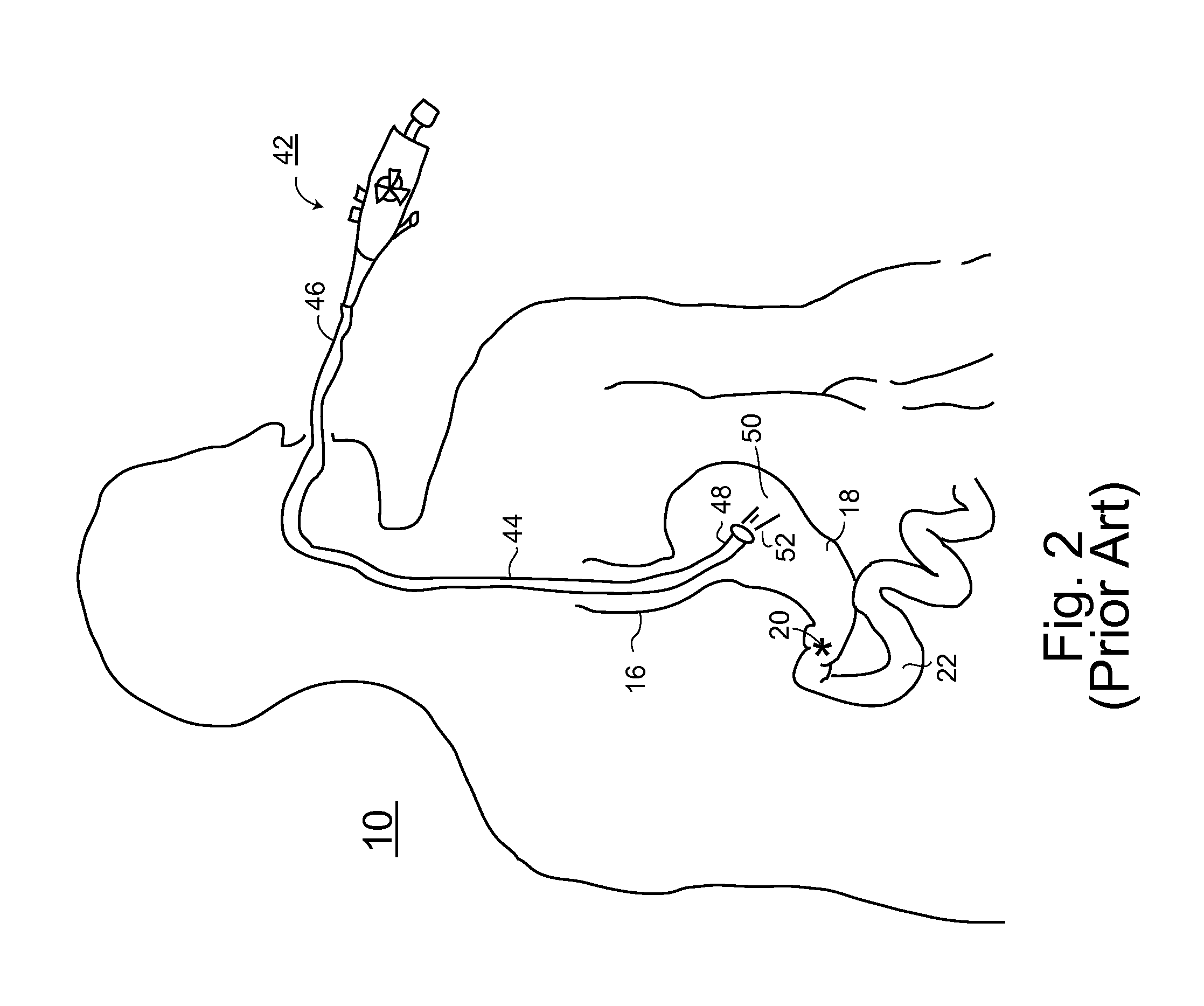 Partially disposable endoscopic device