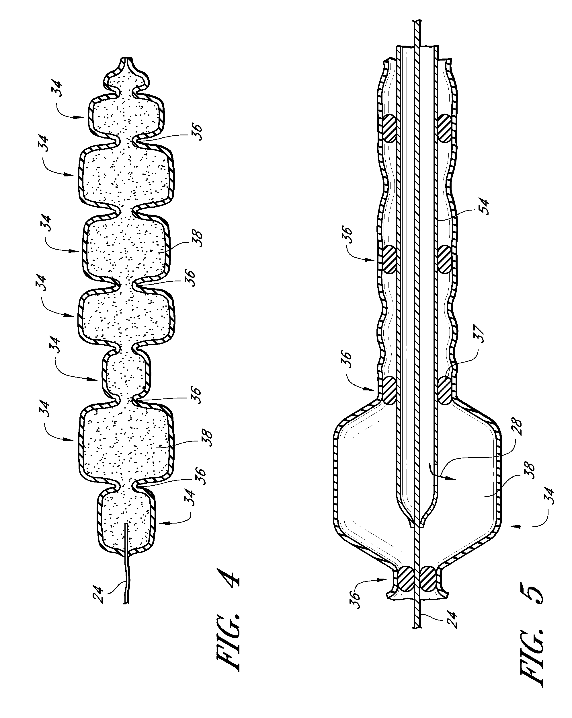 Methods of forming a multilayer tissue implant to create an accordion effect on the outer layer