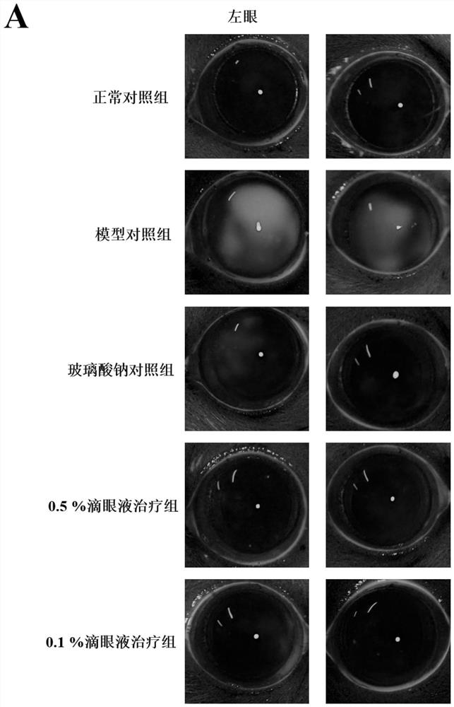 Use of arteether maleate amine for preparation of ophthalmic preparations