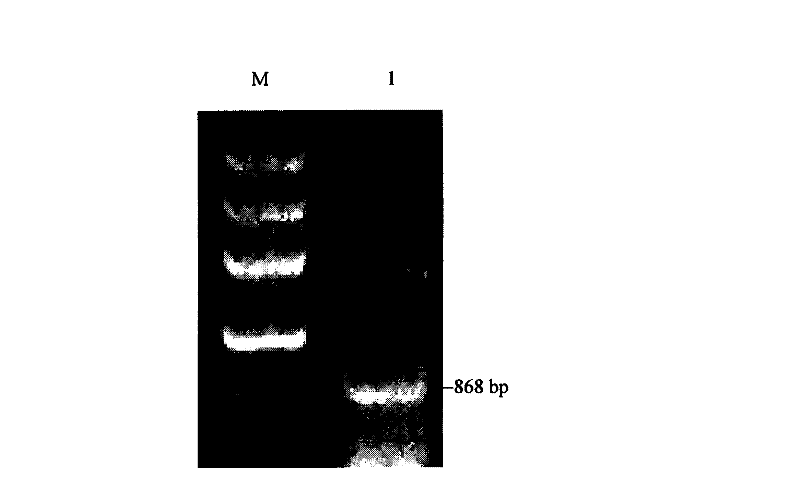 Deoxyhydroxylputrescinelysine synthase code gene and antisense base sequences thereof