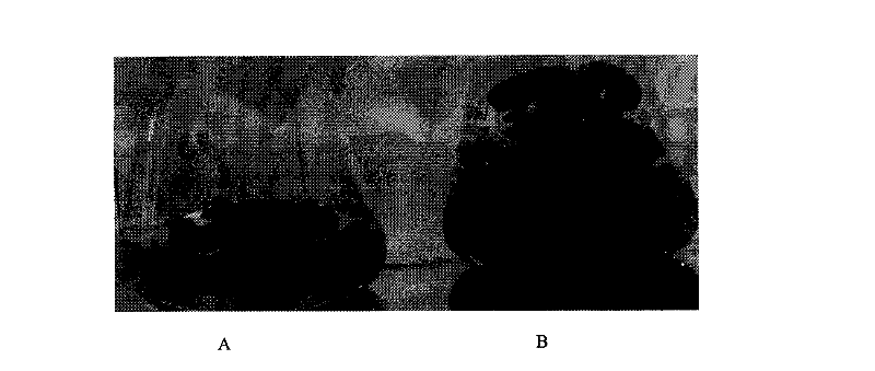 Deoxyhydroxylputrescinelysine synthase code gene and antisense base sequences thereof