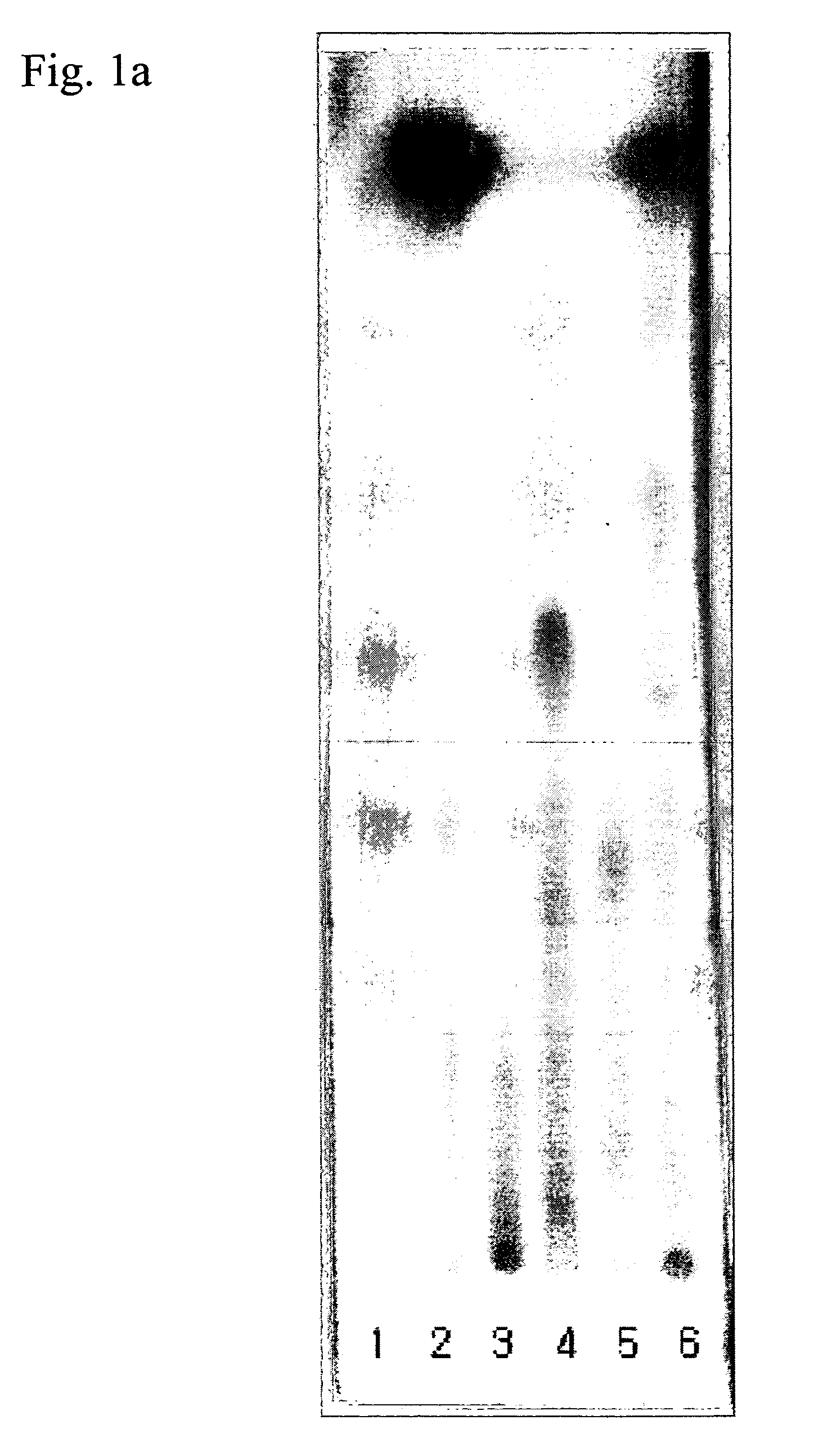 Composition comprising the extract of actinidia arguta and related species for the prevention and treatment of allergic disease and non-allergic inflammatory disease