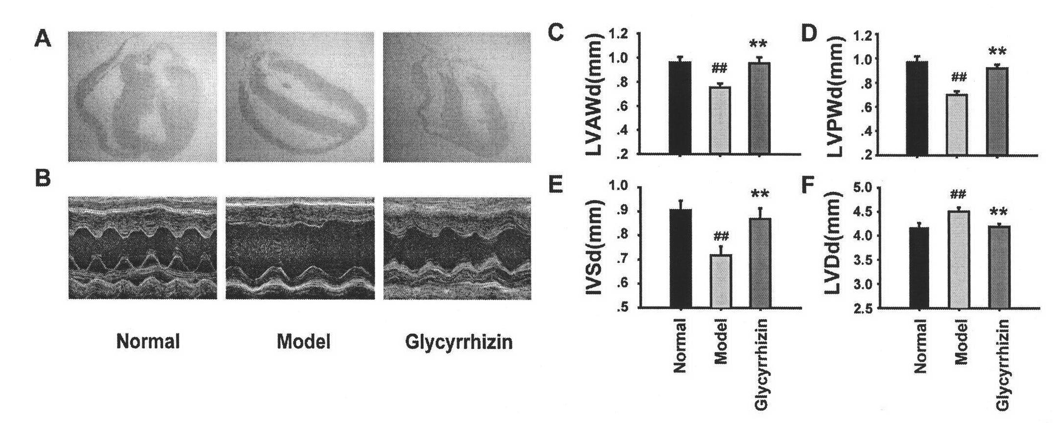 Application of glycyrrhizic acid on treating dilated cardiomyopathy cardiac remodeling and cardiac dysfunction