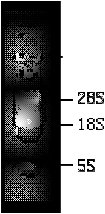 Anti-prothymosin α polyclonal antibody and its preparation method and application