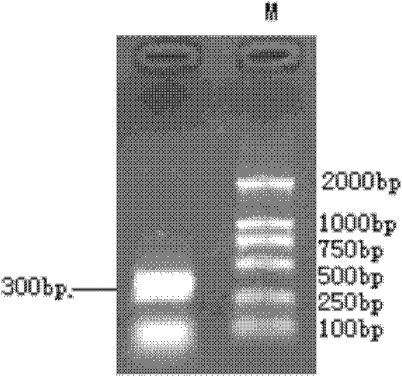 Anti-prothymosin α polyclonal antibody and its preparation method and application