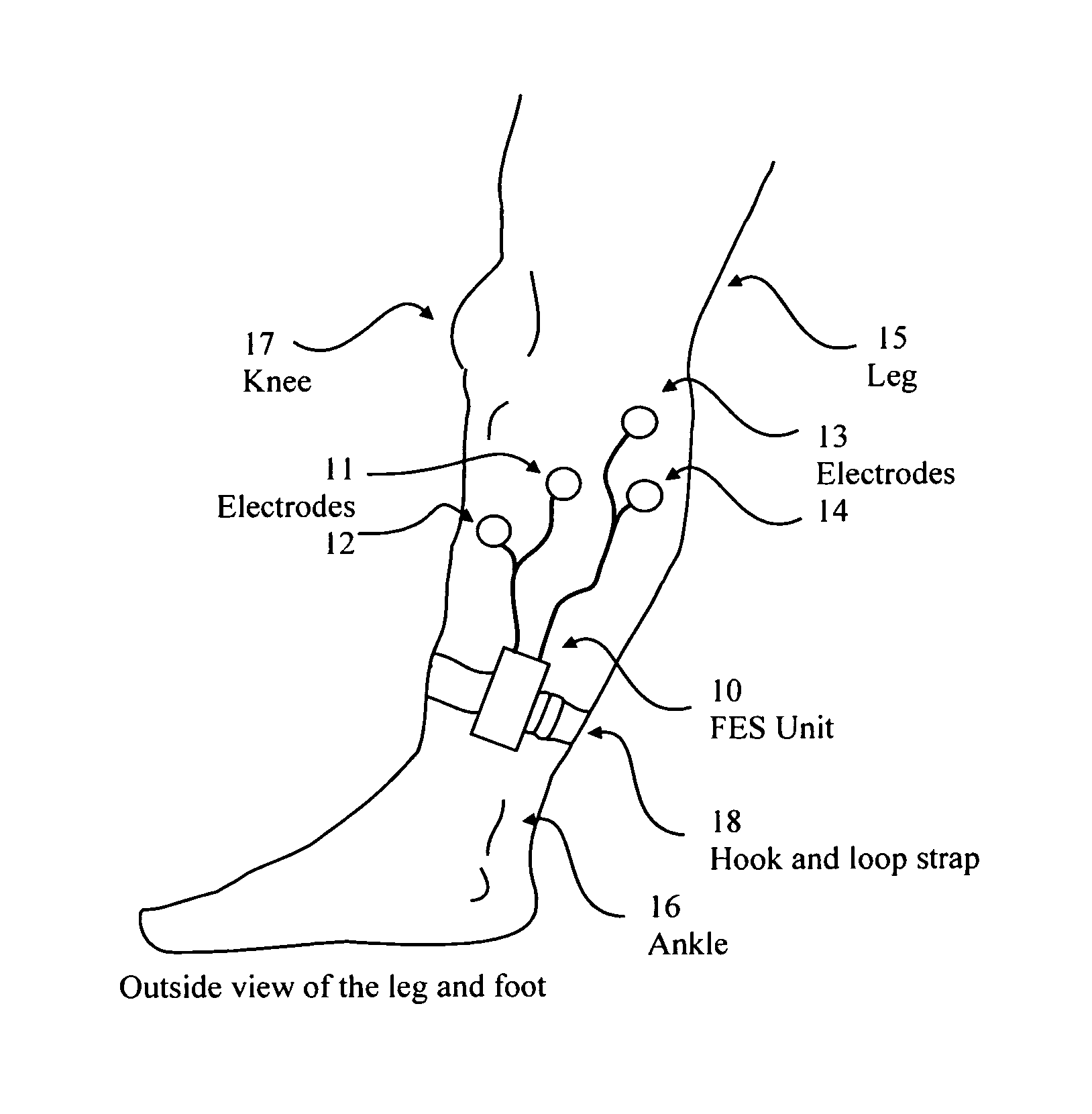 Functional electrical stimulus unit