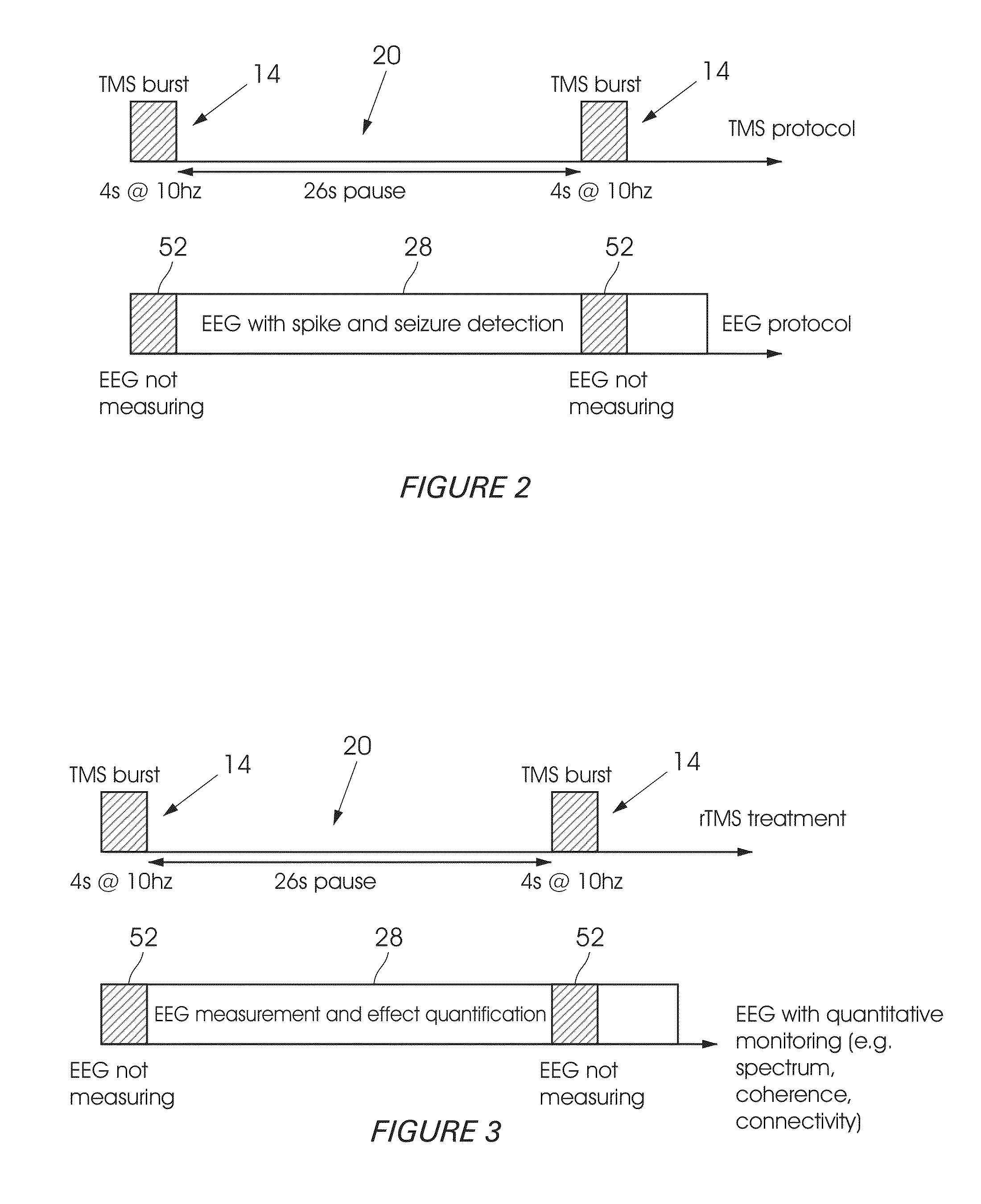 Method and system for tms dose assessment and seizure detection