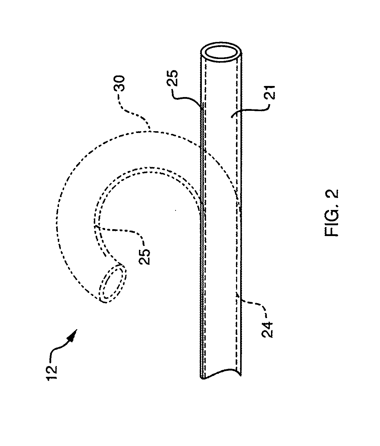 Deflectable sheath catheters