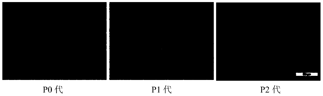 Preparation method of placental-chorionic-plate-tissue-derived mesenchymal stem cells