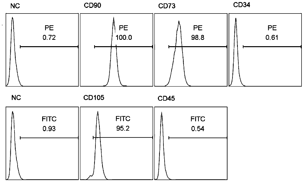 Preparation method of placental-chorionic-plate-tissue-derived mesenchymal stem cells