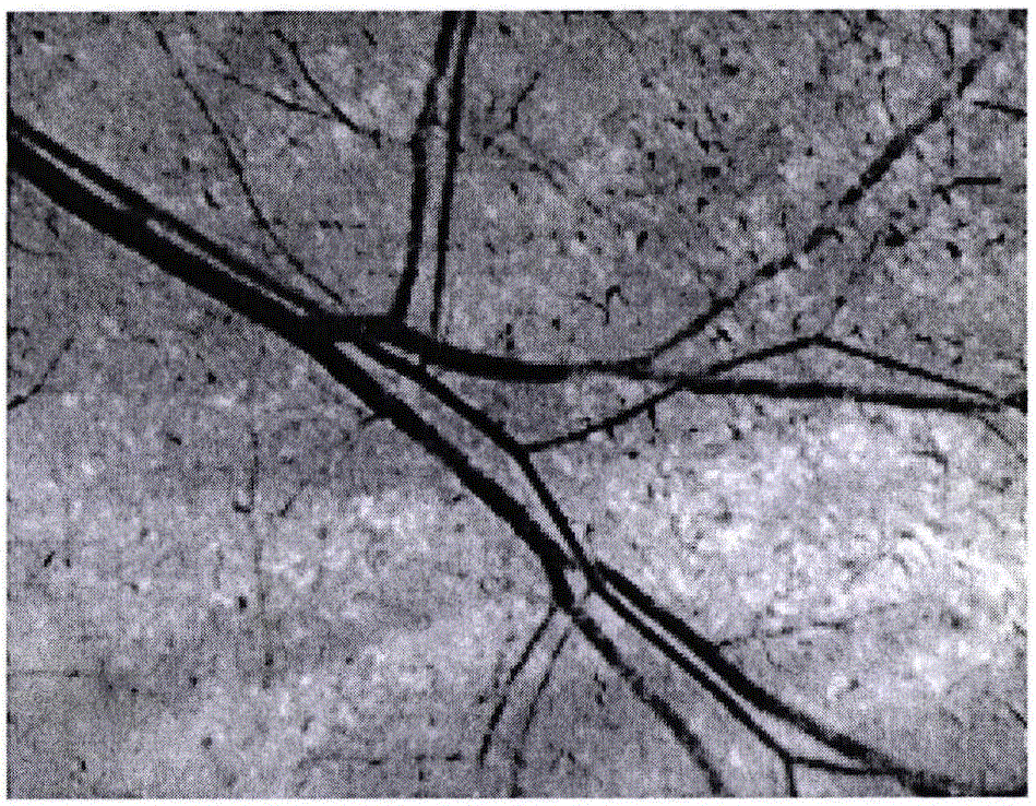 Skin tissue optical clearing solution, and preparation method and applications thereof